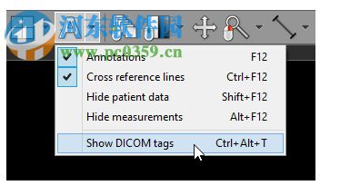 RadiAnt DICOM Viewer(圖片瀏覽) 1.1.8 官方版