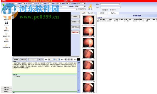 內(nèi)窺鏡影像工作站 13.2 官方版