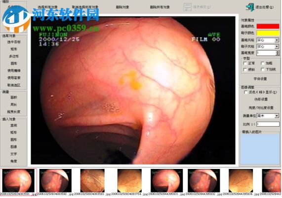 ProDicom Workstation(醫(yī)網(wǎng)聯(lián)影像工作站) 4.0 官方版