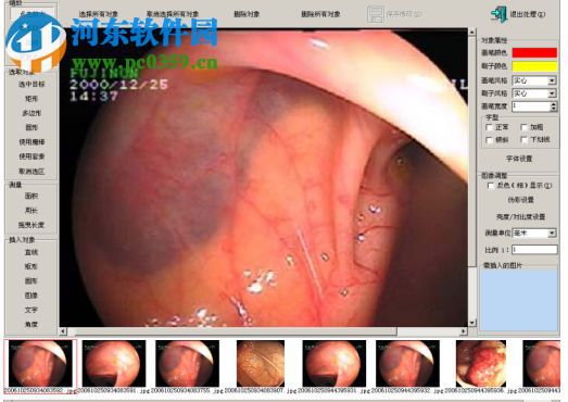 ProDicom Workstation(醫(yī)網(wǎng)聯(lián)影像工作站) 4.0 官方版