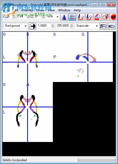 mriCroN(醫(yī)學(xué)影像分析軟件) 4.0 免費(fèi)版